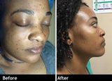 Glutathione Skin Lightening Suppositories