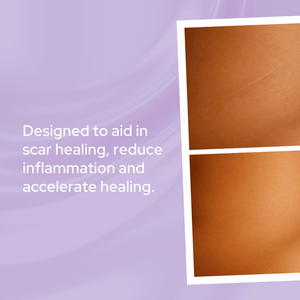Power Glow | Scar & Stretch Mark Treatment