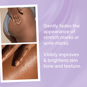 Power Glow | Scar & Stretch Mark Treatment